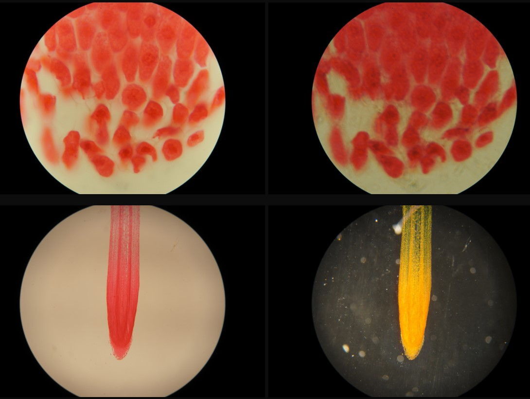 Olympus PerioMicro30 Dental Microscope Digital Camera Large Monitor [v1180044660]