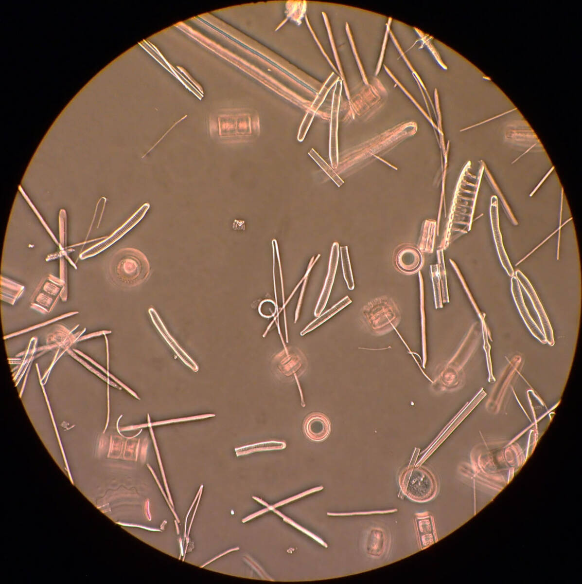 Olympus BH2 Phase Contrast Microscope Digital Camera Set for Bacteria Blood Observation Dentistry [s1213742616]