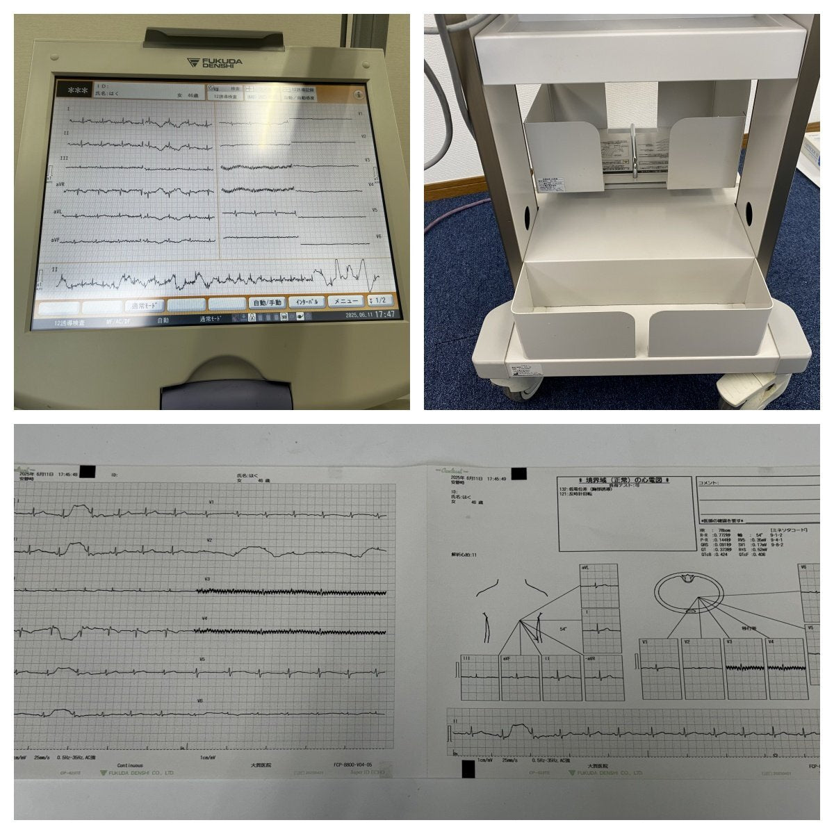 Fukuda Denshi Cardimax FCP-8800 Electrocardiograph [q1190354333]