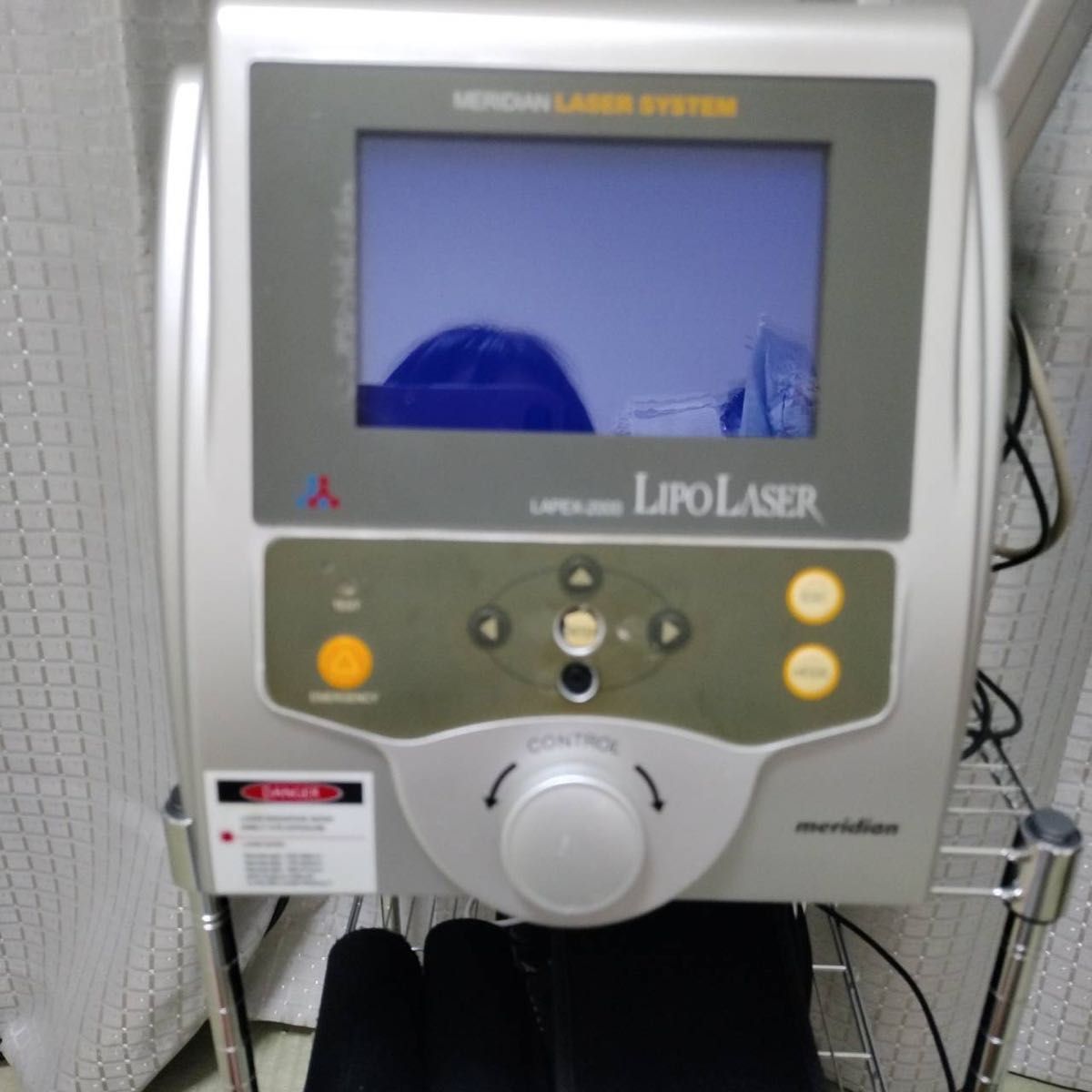 Meridian LAPEX-2000 LIPO LASER Body Contouring Device [z663844092]