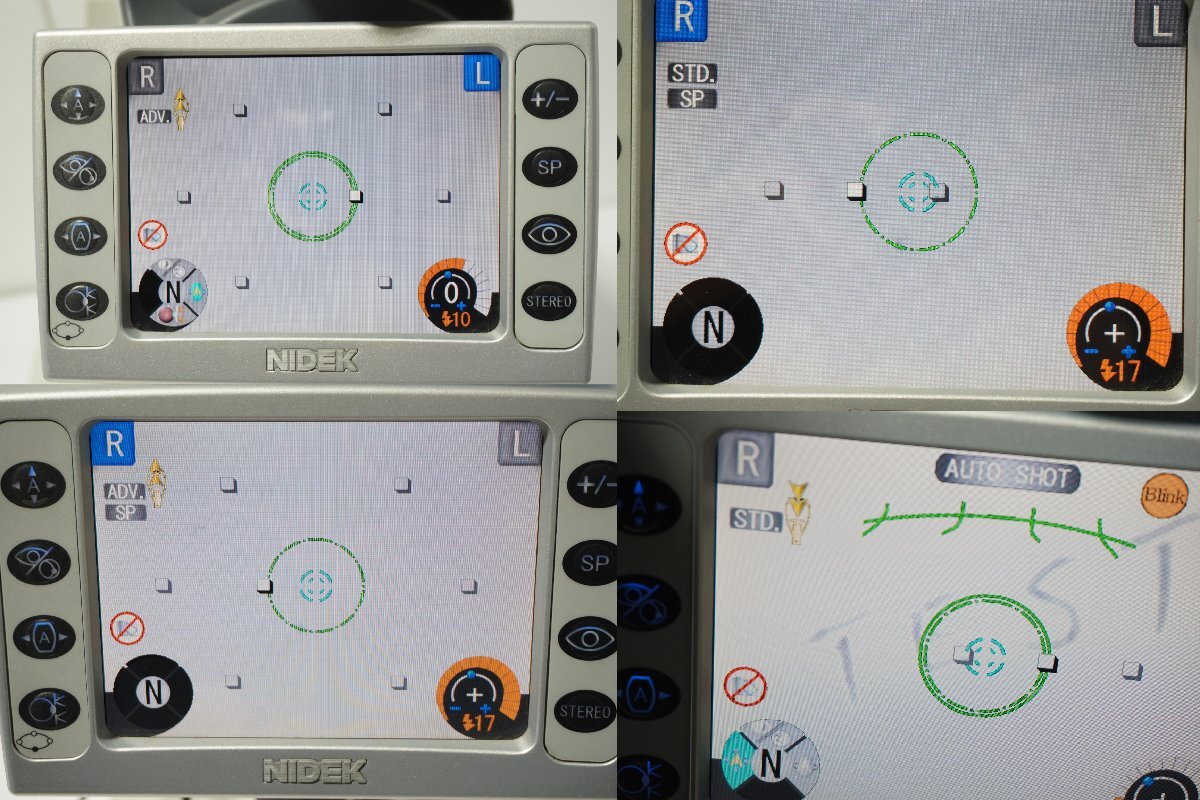 Nidek AFC-210 Auto Non-Mydriatic Fundus Camera (for parts or not working) [u1247608900]