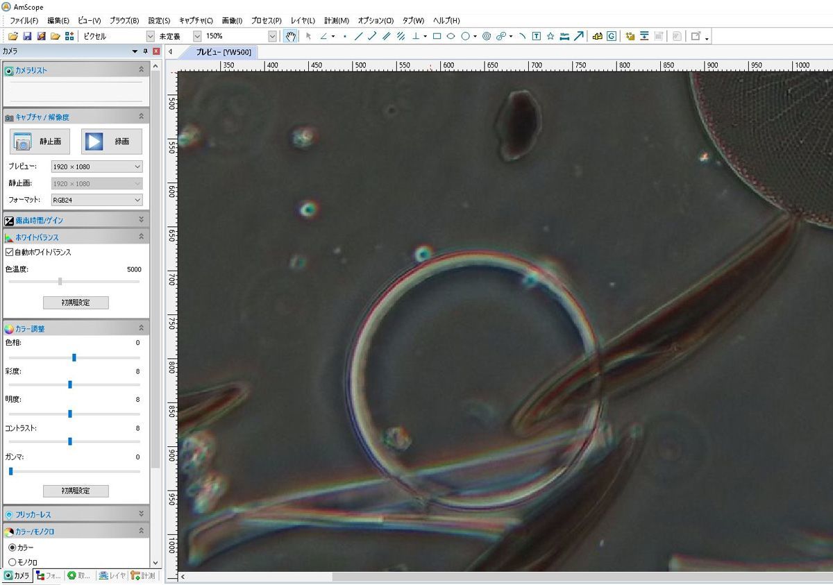 Olympus Phase Contrast Microscope Digital Camera Output for Bacteria Microorganisms Blood Observation [1193381354]