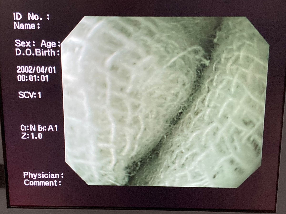 OLYMPUS GIF-PQ260 Endoscope EVIS LUCERA Video Scope [w1192412638]