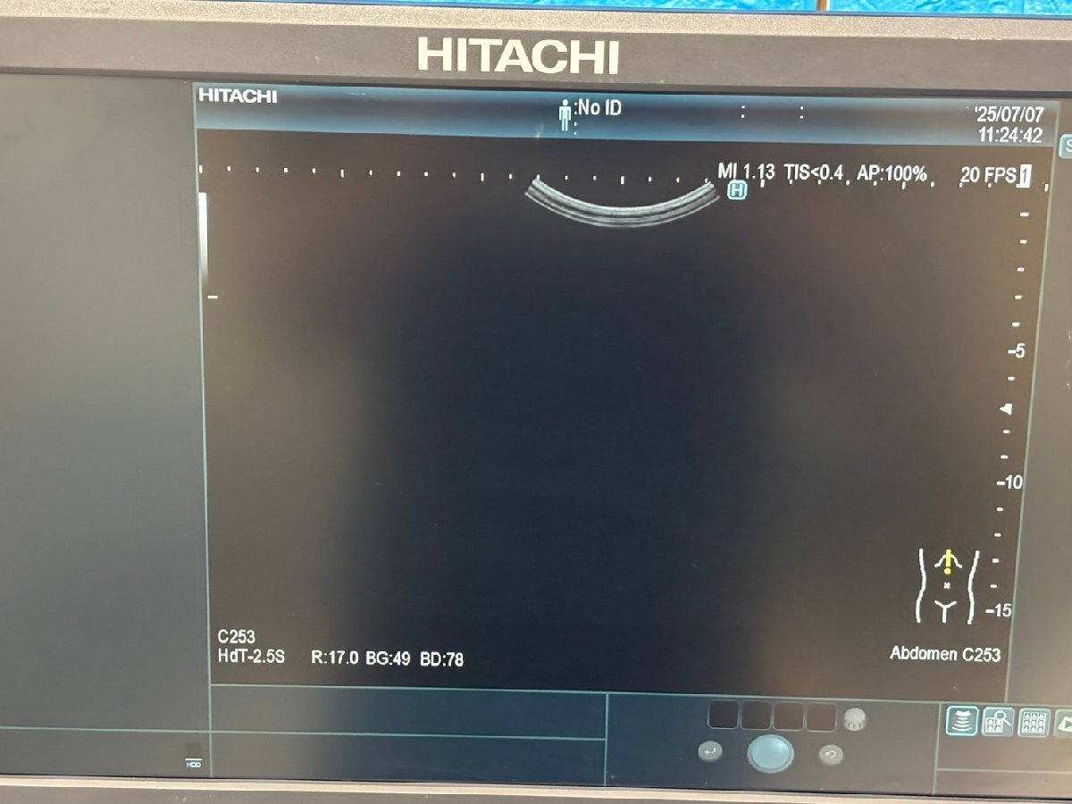 Hitachi Arietta 65 Ultrasound Diagnostic System [p1191683732]