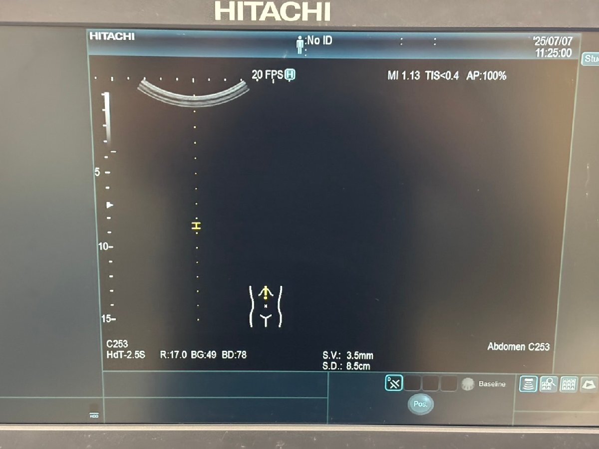 Hitachi Arietta 65 Ultrasound Diagnostic System [p1191683732]