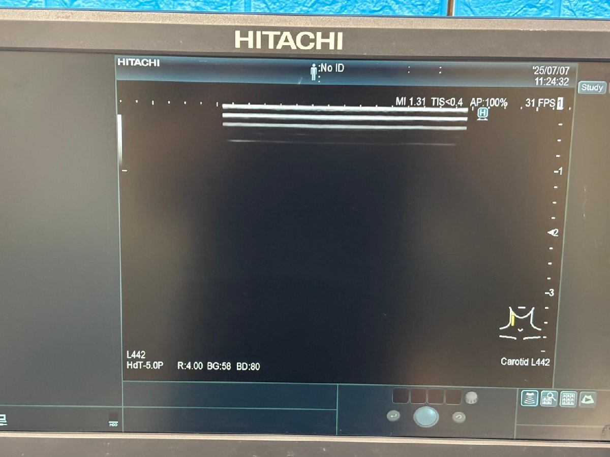 Hitachi Arietta 65 Ultrasound Diagnostic System [p1191683732]