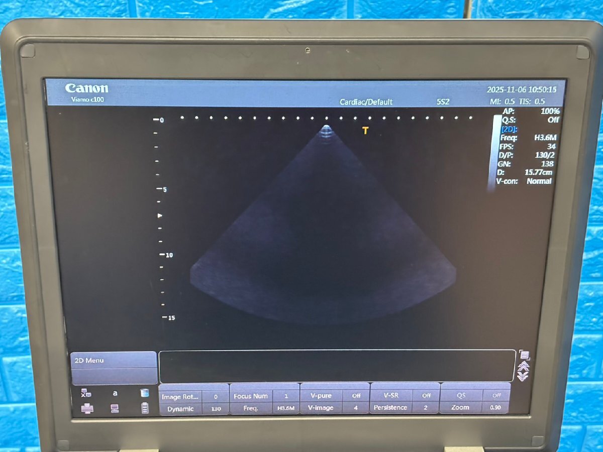 Canon Viamo C100 Ultrasound Diagnostic System [o1206831553]