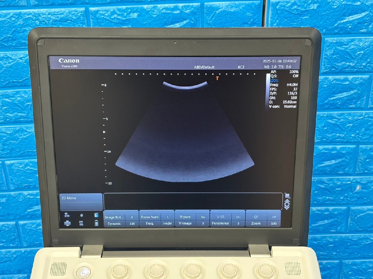 Canon Viamo C100 Ultrasound Diagnostic System [o1206831553]