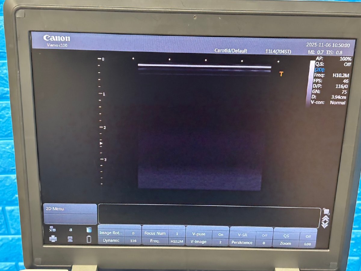 Canon Viamo C100 Ultrasound Diagnostic System [o1206831553]
