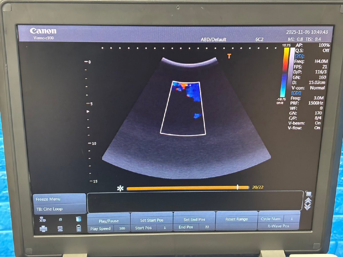 Canon Viamo C100 Ultrasound Diagnostic System [o1206831553]