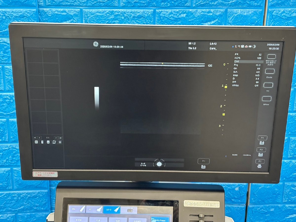 GE Versana Premier Ultrasound Diagnostic System [t1219145462]