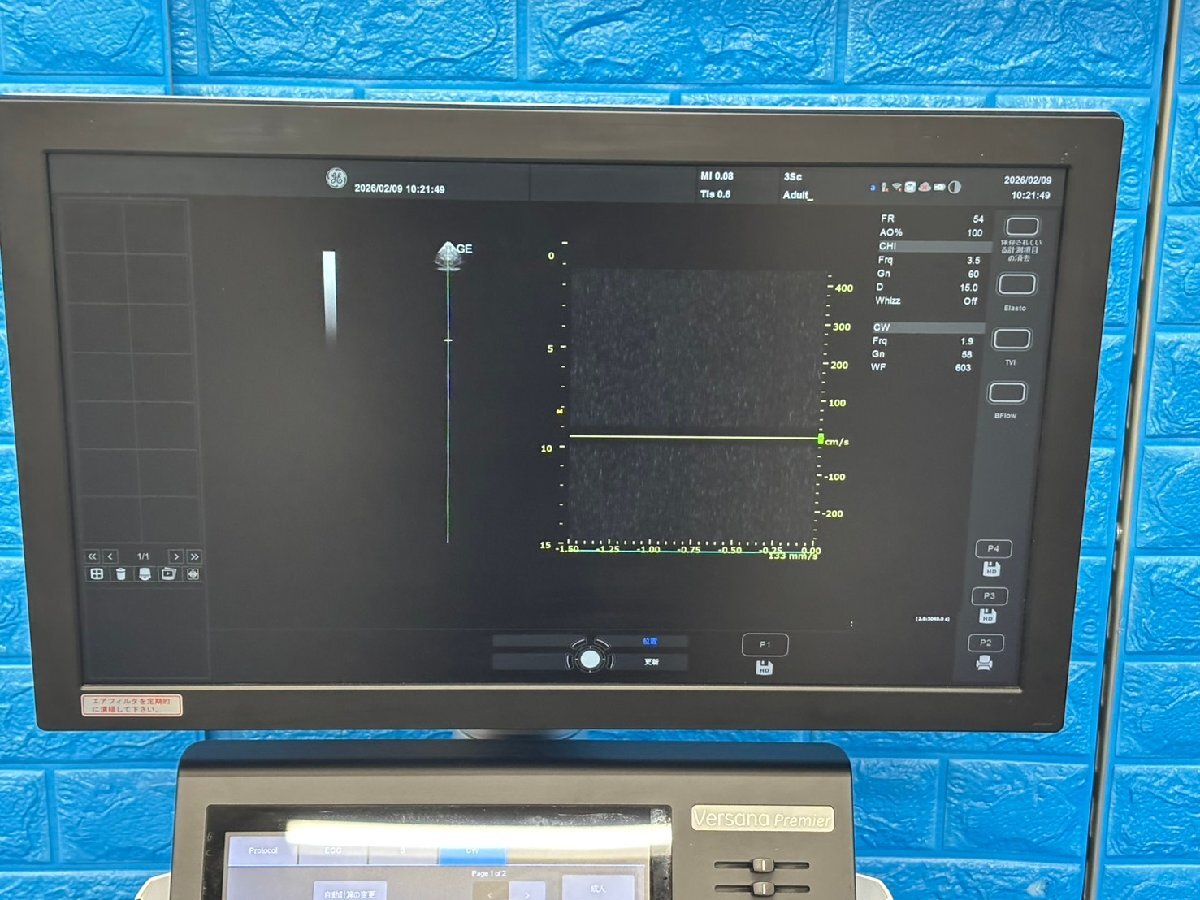 GE Versana Premier Ultrasound Diagnostic System [t1219145462]