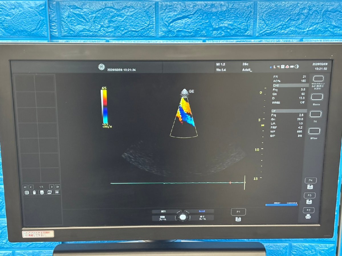 GE Versana Premier Ultrasound Diagnostic System [t1219145462]