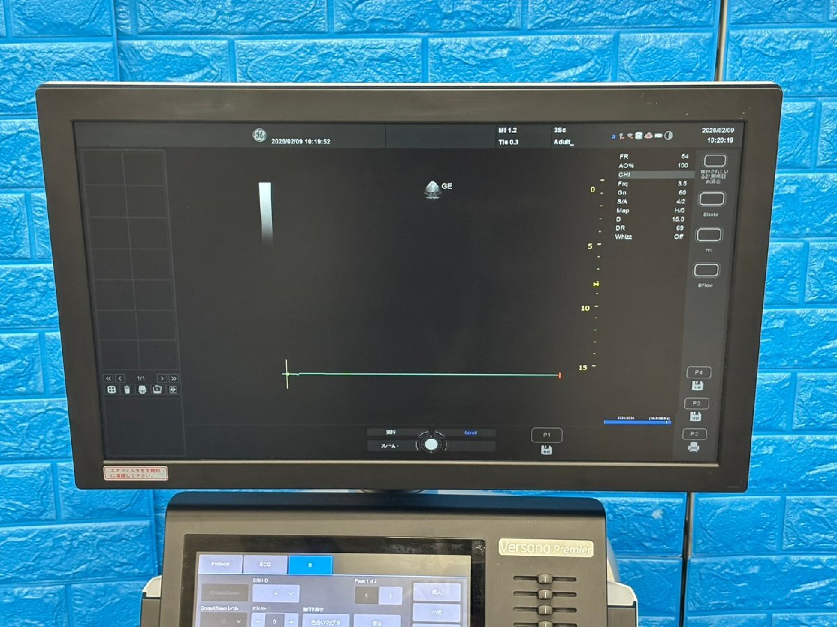 GE Versana Premier Ultrasound Diagnostic System [t1219145462]
