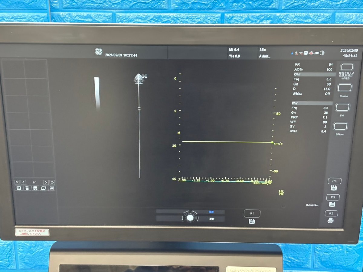GE Versana Premier Ultrasound Diagnostic System [t1219145462]