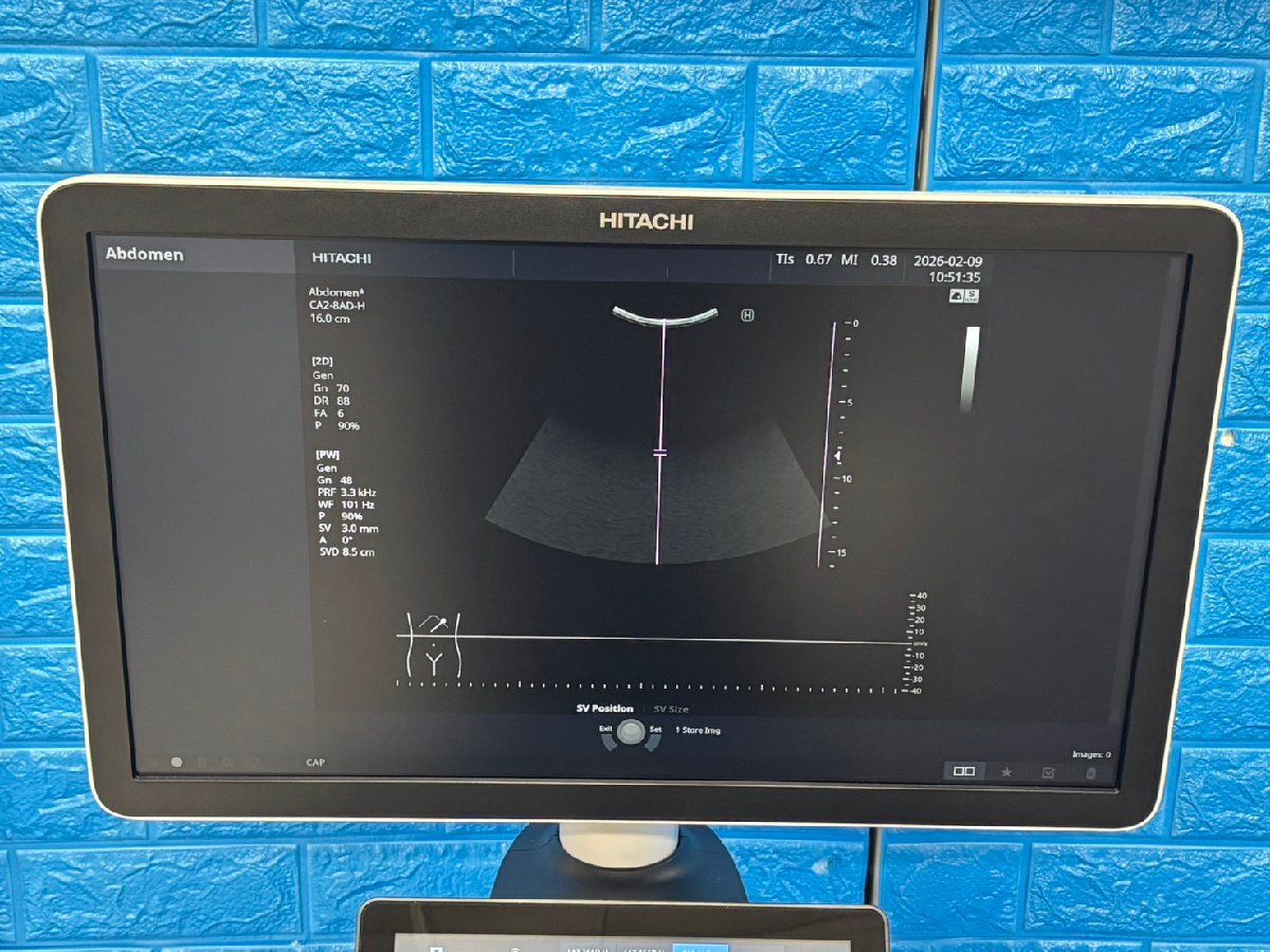 Hitachi FUTUS Ultrasound Diagnostic System [q1219145571]
