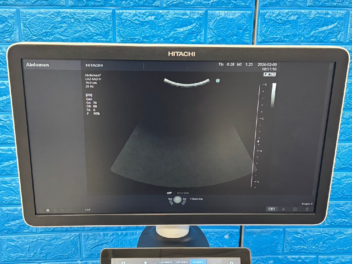 Hitachi FUTUS Ultrasound Diagnostic System [q1219145571]