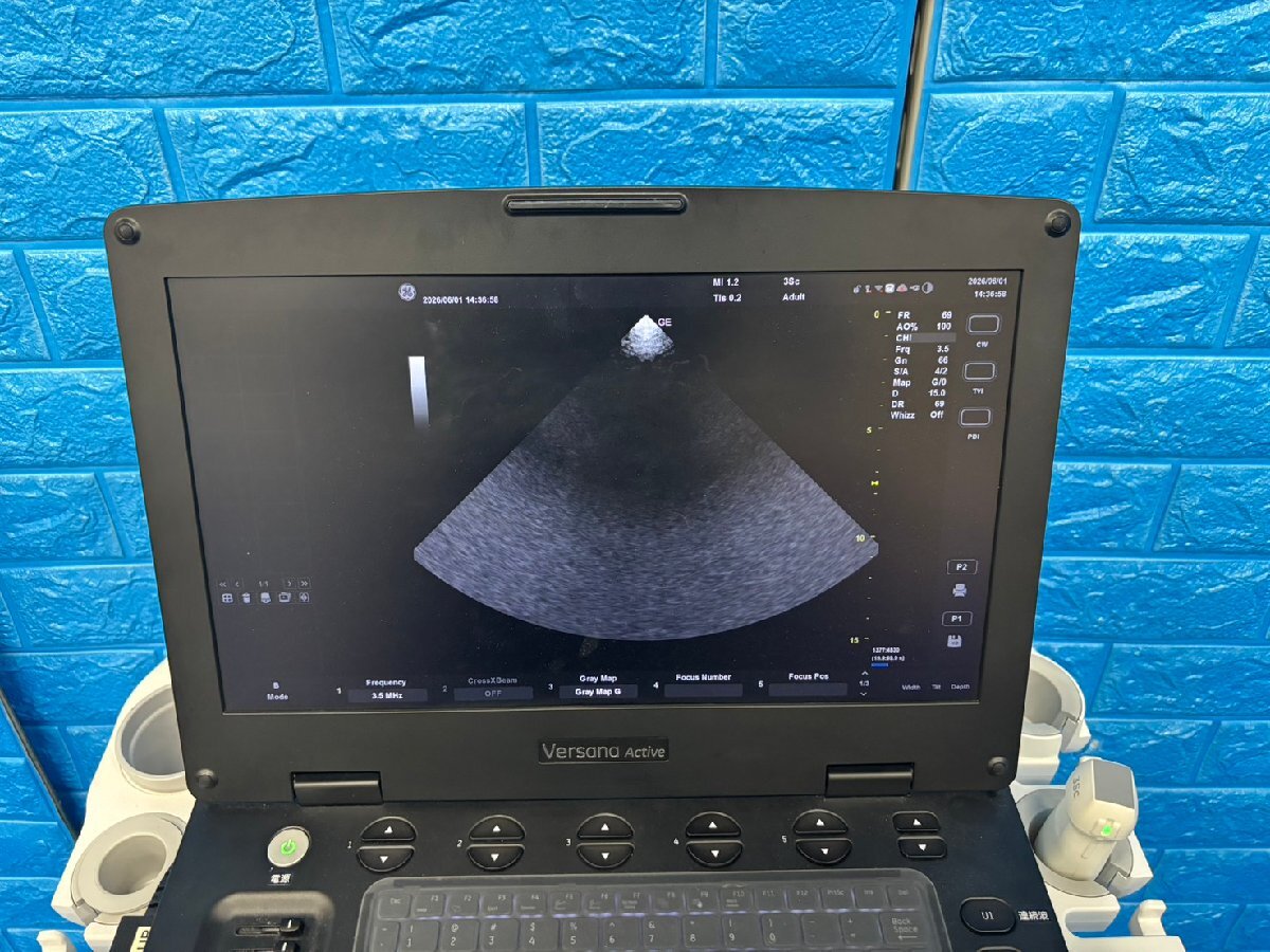 GE Versana Active Ultrasound Diagnostic System [e1232183133]