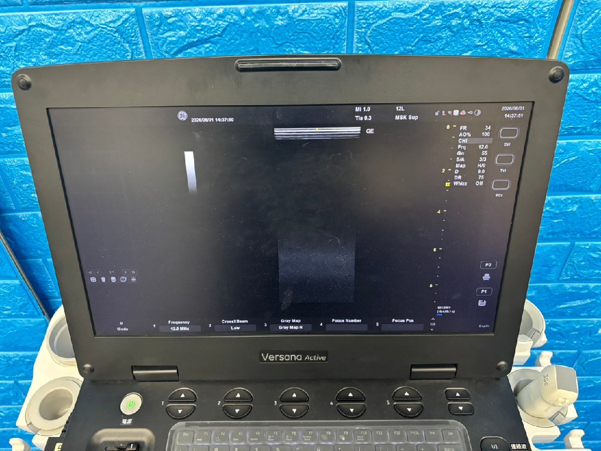 GE Versana Active Ultrasound Diagnostic System [e1232183133]