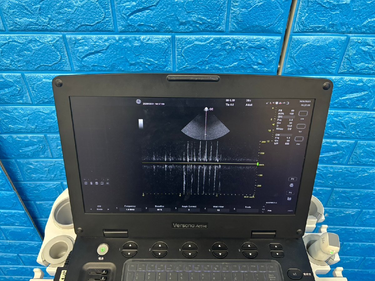 GE Versana Active Ultrasound Diagnostic System [e1232183133]