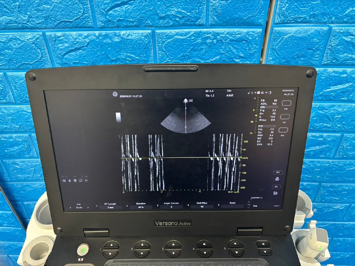 GE Versana Active Ultrasound Diagnostic System [e1232183133]