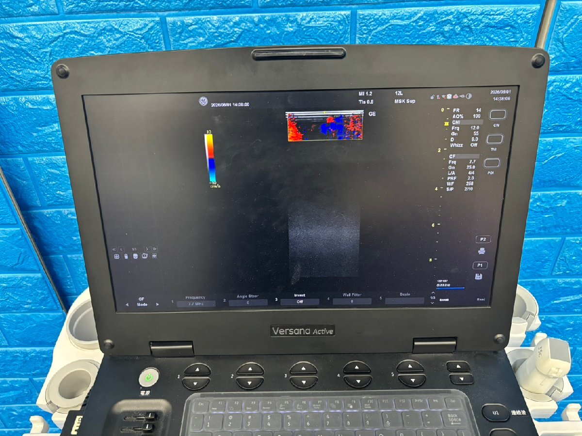 GE Versana Active Ultrasound Diagnostic System [e1232183133]