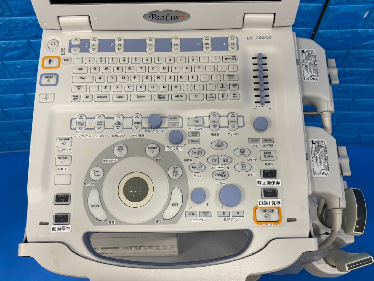 Fukuda Denshi UF-760AG+ Ultrasound Diagnostic System [p1236359183]