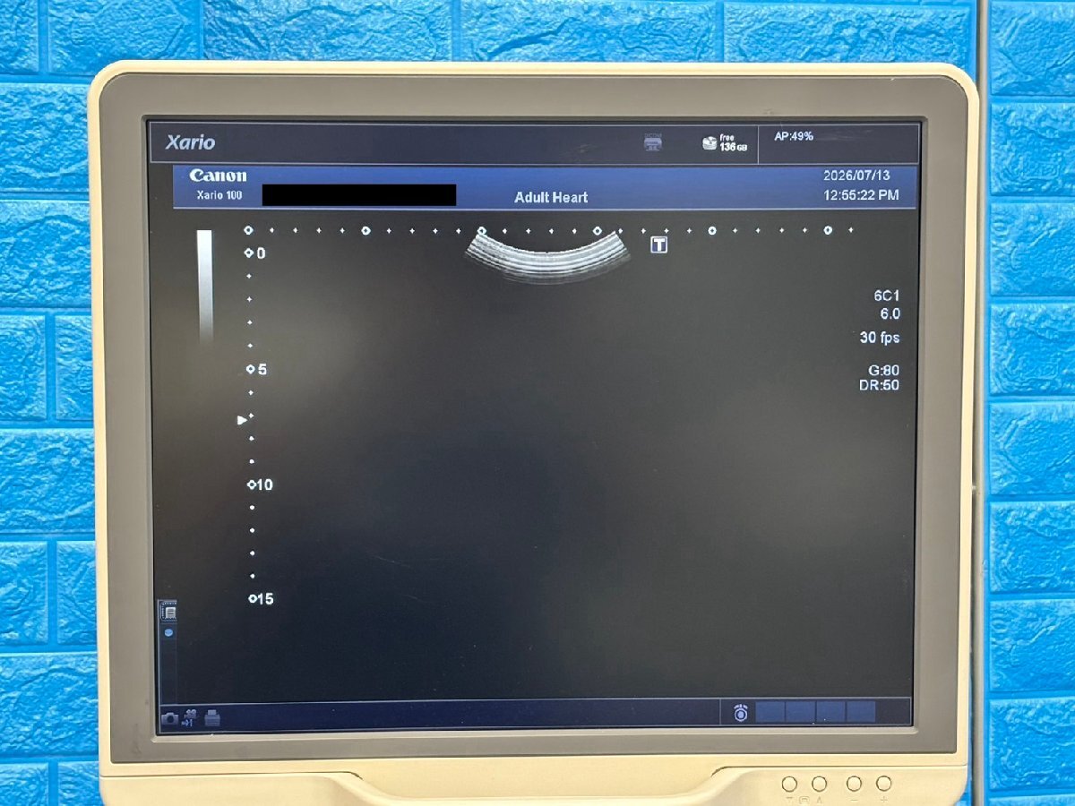 Toshiba Canon Xario 100 Ultrasound Diagnostic System [r1237320824]
