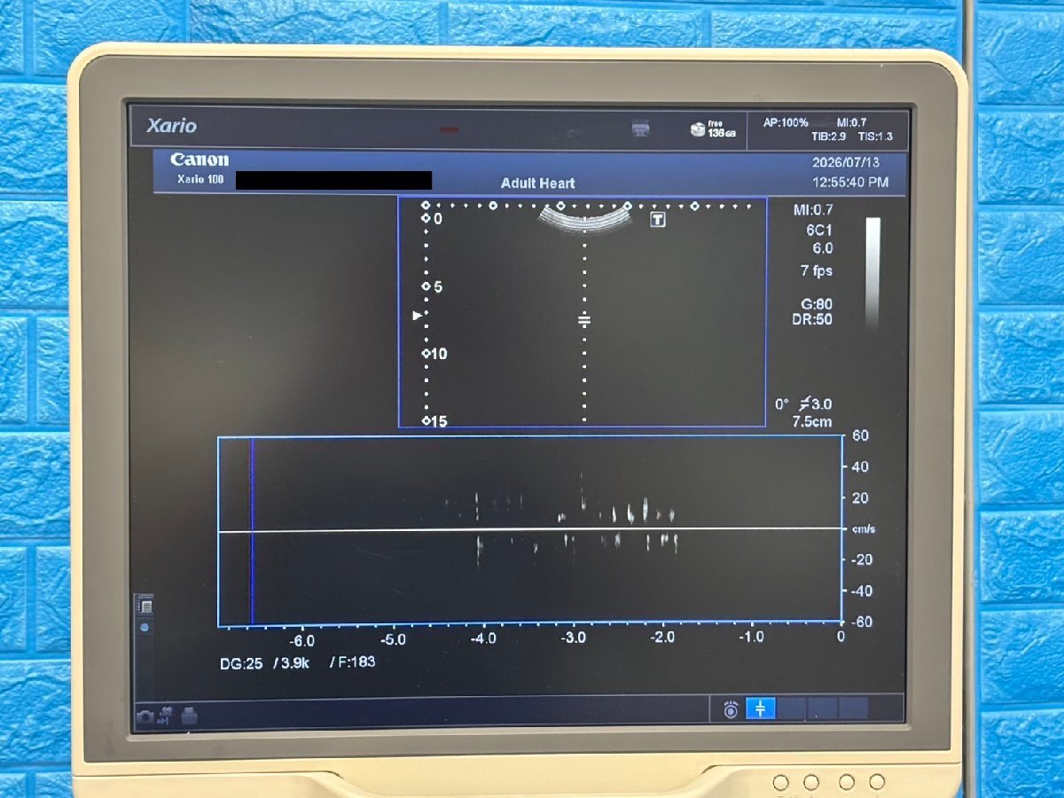 Toshiba Canon Xario 100 Ultrasound Diagnostic System [r1237320824]