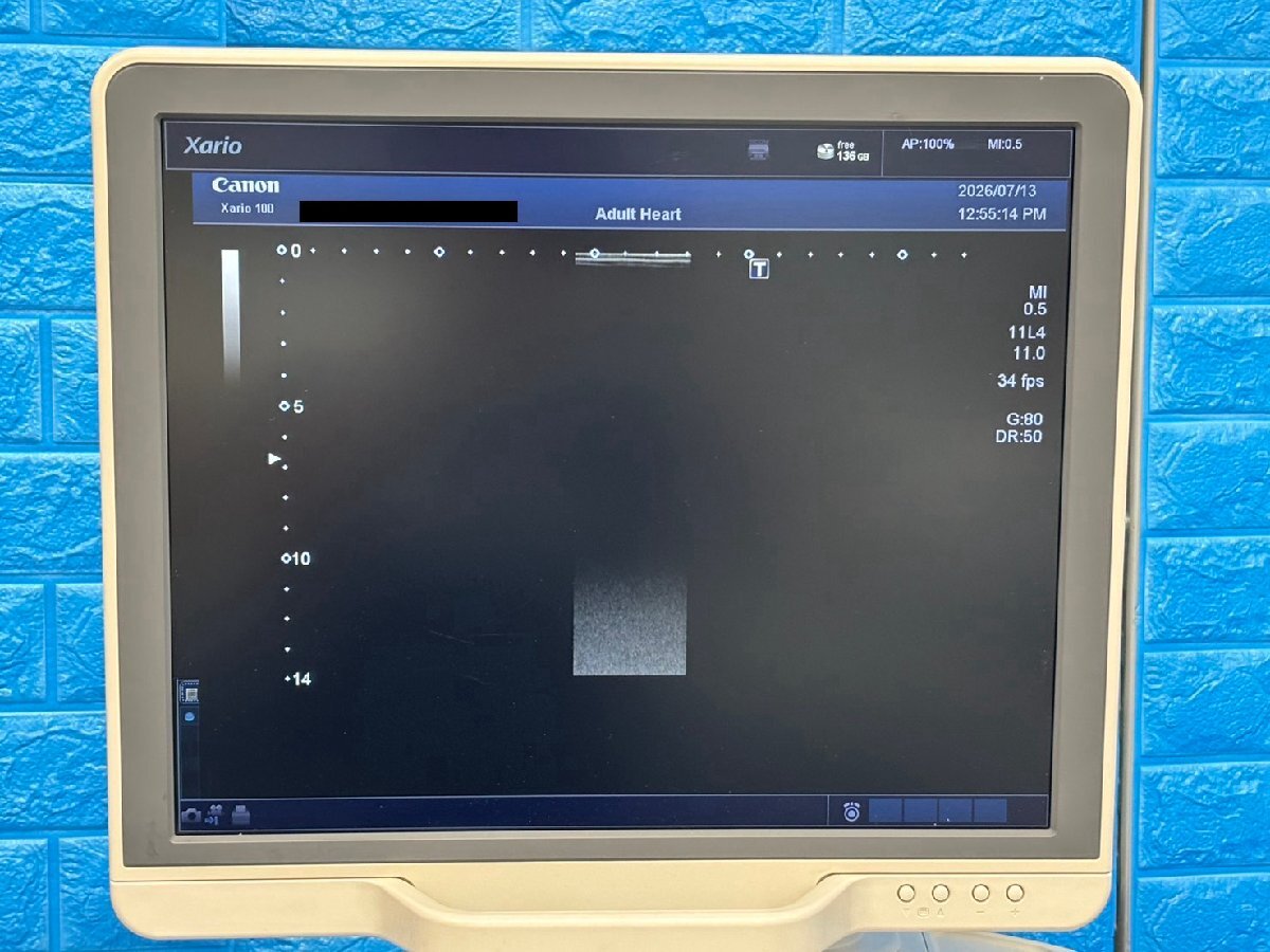 Toshiba Canon Xario 100 Ultrasound Diagnostic System [r1237320824]