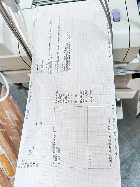 Fukuda Denshi VS-1500E Blood Pressure and Atherosclerosis Testing Device with 12-Lead ECG [b1241686309]