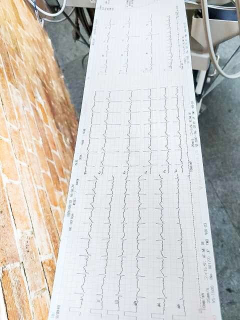 Fukuda Denshi VS-1500E Blood Pressure and Atherosclerosis Testing Device with 12-Lead ECG [b1241686309]
