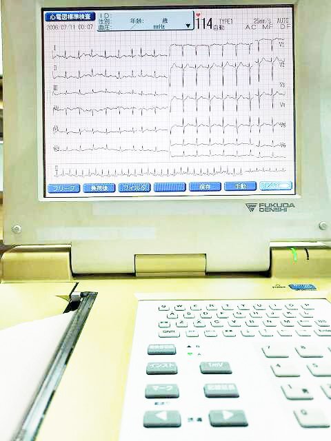 Fukuda FCP-7541 ECG Monitor with Automatic Analysis and Stand [f1241689177]