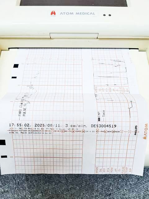 Philips FM20 Fetal Monitor [j1249035590]