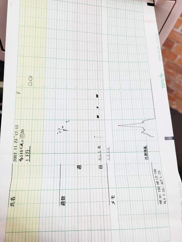 Toytsu MT-516 Obstetric Actocardiograph Measuring Instrument [d1211767611]