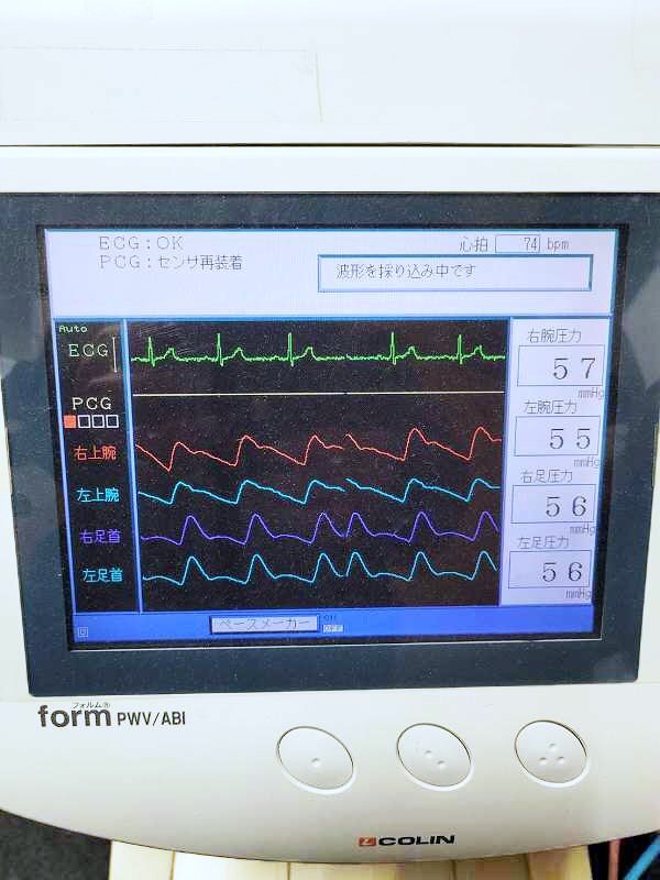 Korin Medical Technology PWV/ABI BP-203RPE2 Blood Pressure Pulse Wave Test Device [o1218744754]