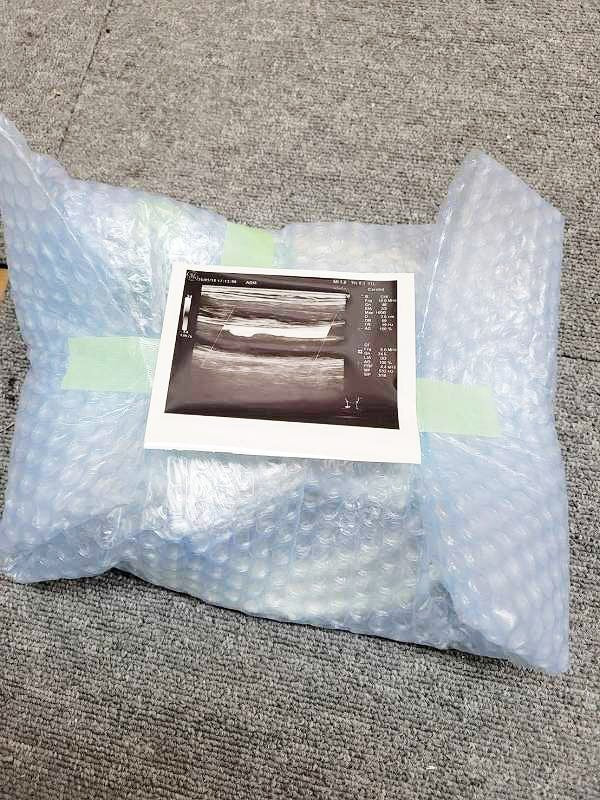 GE Healthcare 11L Linear Probe Medical Equipment [o1232797705]