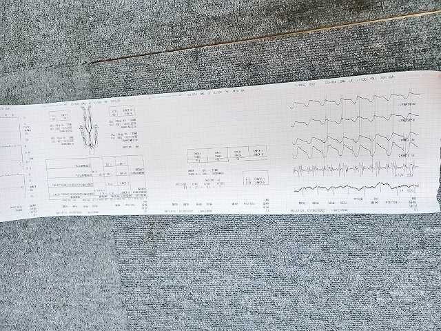 Fukuda Denshi VS-1500E Blood Pressure and Atherosclerosis Testing Device with 12-Lead ECG [b1241686309]