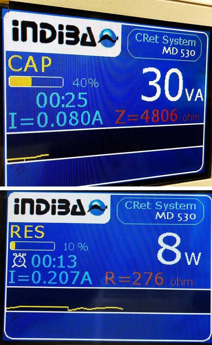 INDIBA MD530 High Frequency Thermal Device [c1248306502]