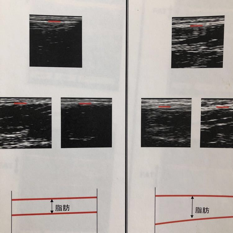Ultrasound Echo Body Measurement Device [k401093016]