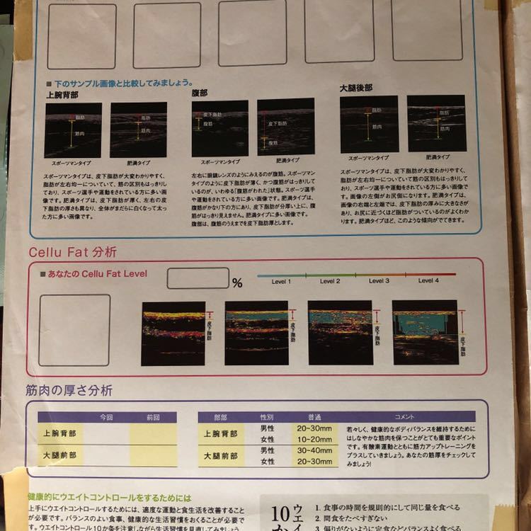 Ultrasound Echo Body Measurement Device [k401093016]