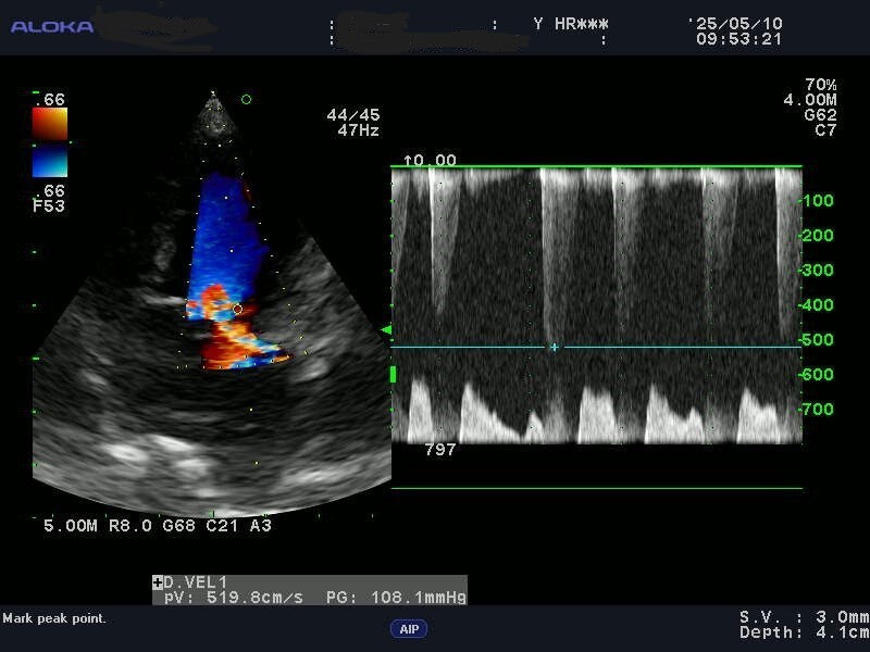 ALOKA ProSound α7 Ultrasound Imaging Device [h1217930152]