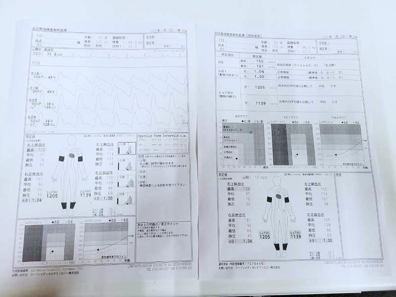 Korin Medical Technology PWV/ABI BP-203RPE2 Blood Pressure Pulse Wave Test Device [o1218744754]