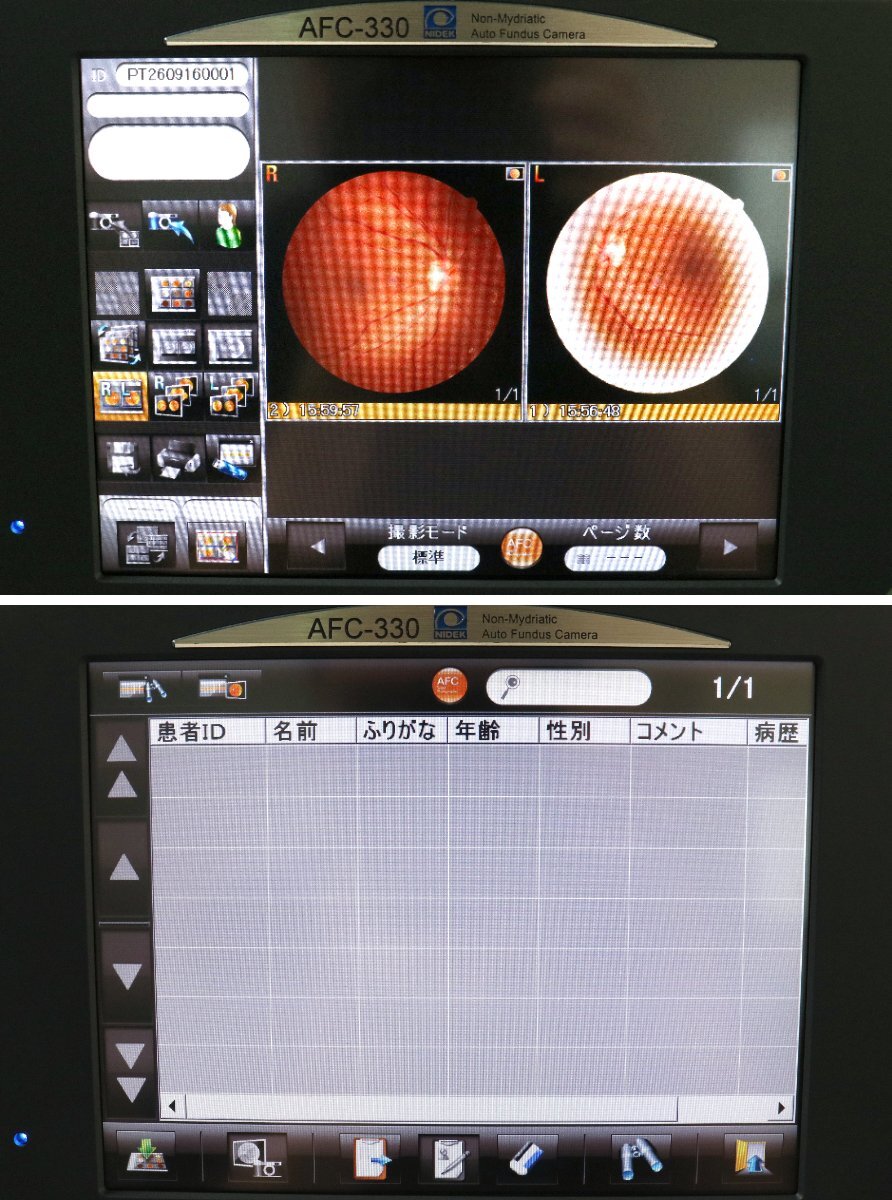 NIDEK AFC-330 Non-Mydriatic Auto Fundus Camera [e1246643646]