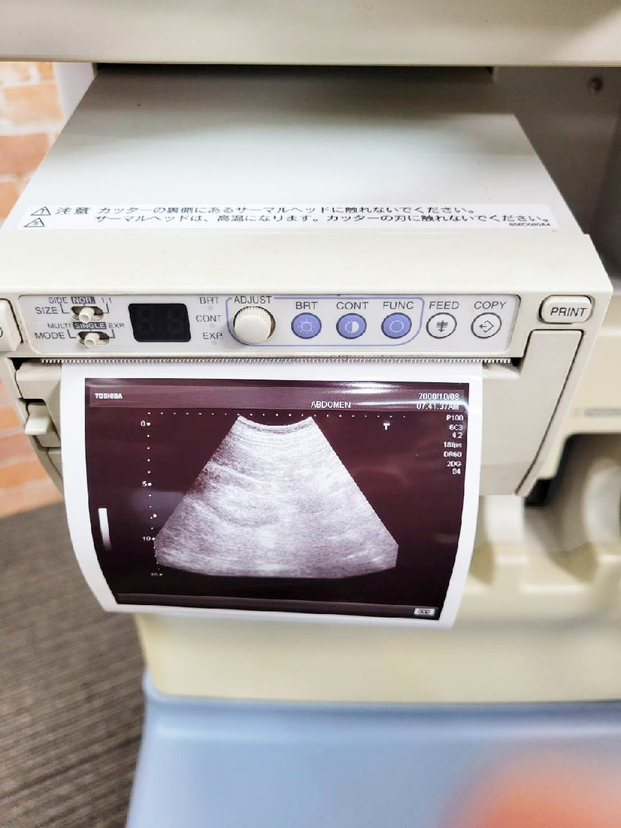 Toshiba Nemio17 Ultrasonic Diagnostic Attachment [u1177656517]