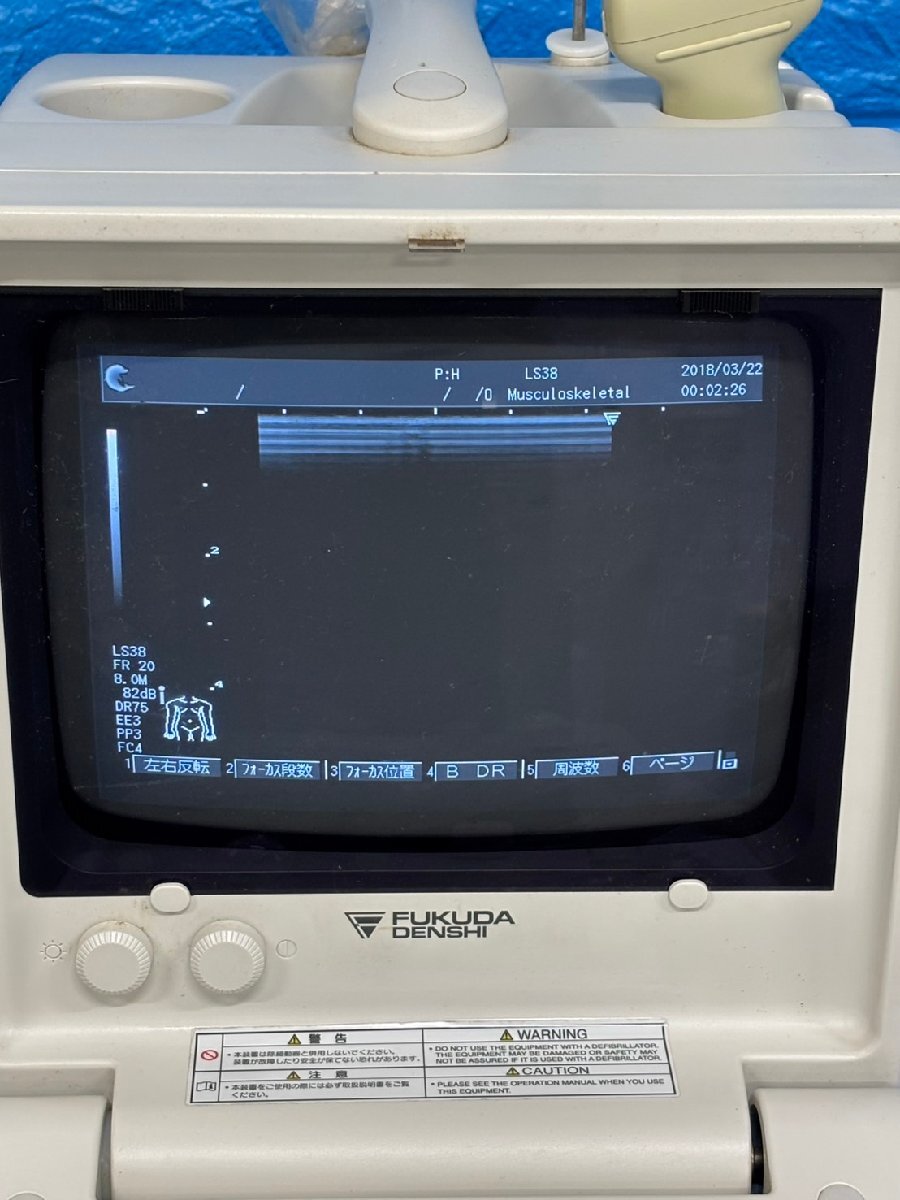 Fukuda Electronics UF-400AX Ultrasound Diagnostic Device [s1187362474]