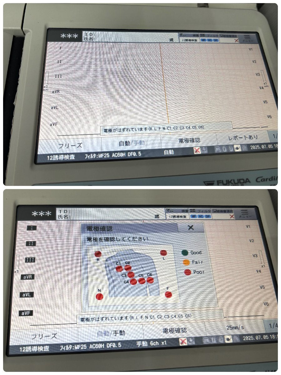 Fukuda Denshi FCP-8300 Electrocardiogram Cardimax [k1191489754]