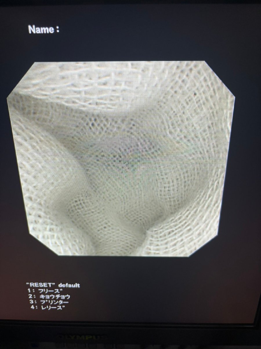 OLYMPUS PCF-P240I Colon Videoscope Endoscope [e1192421363]