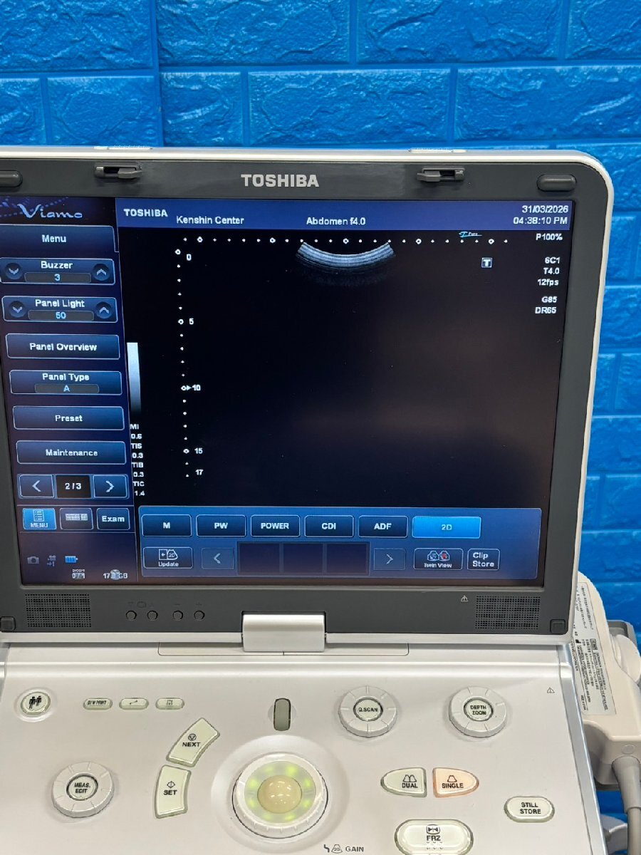 Toshiba Viamo Ultrasound Diagnostic System [s1226499175]