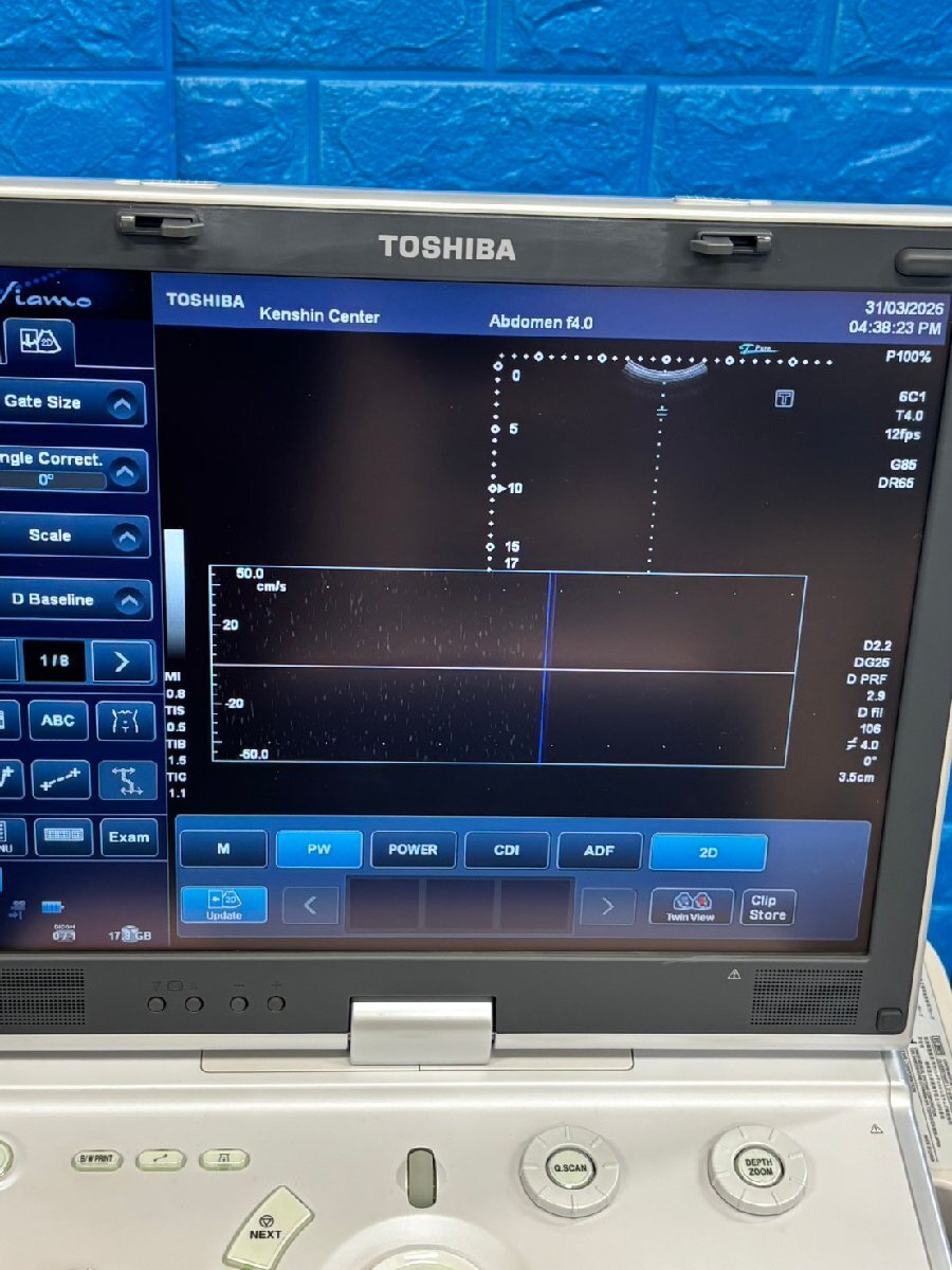 Toshiba Viamo Ultrasound Diagnostic System [s1226499175]